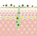 ハーブオブトリートメント