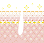 ハーブオブトリートメント